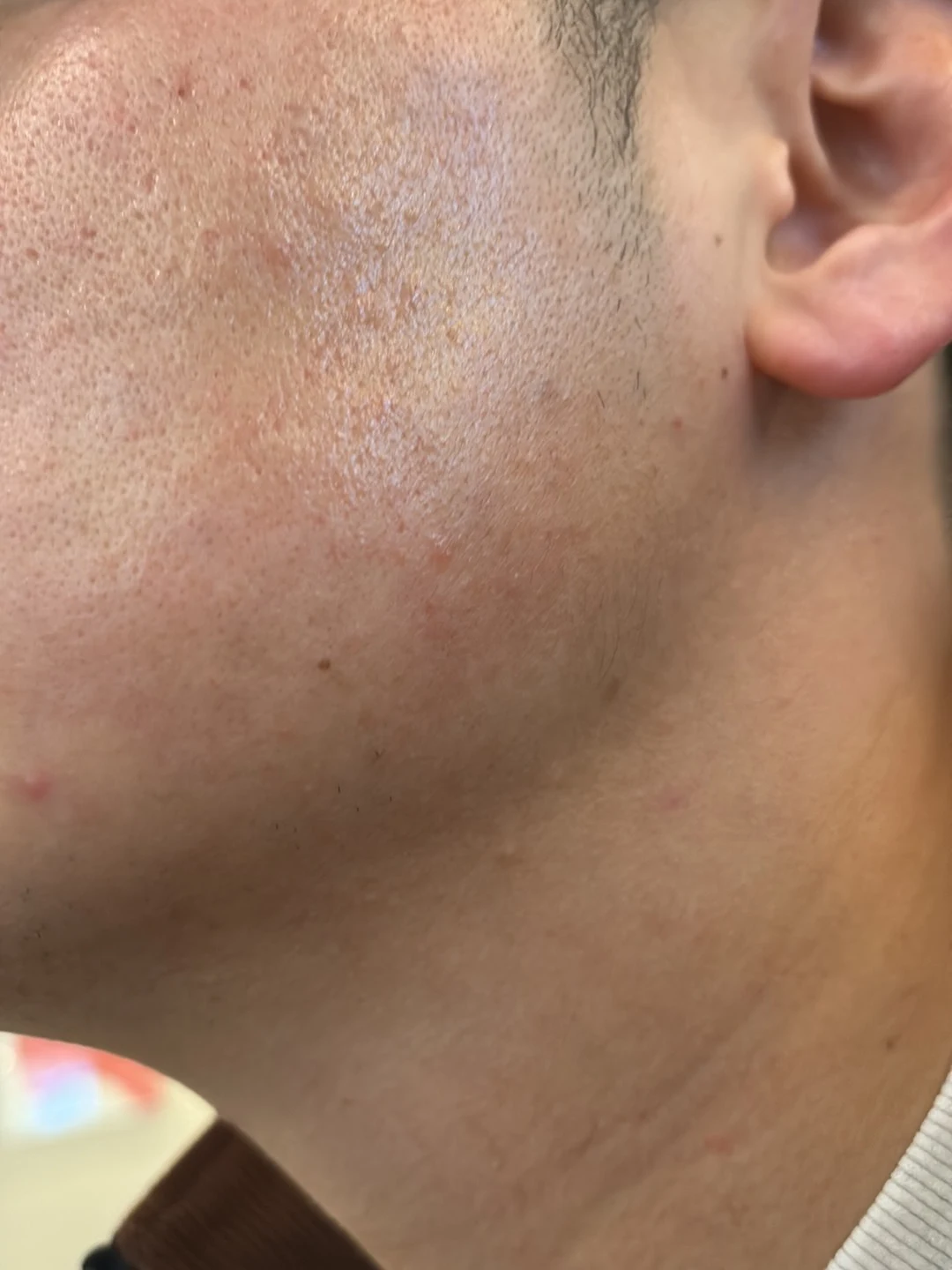 수술후기이미지