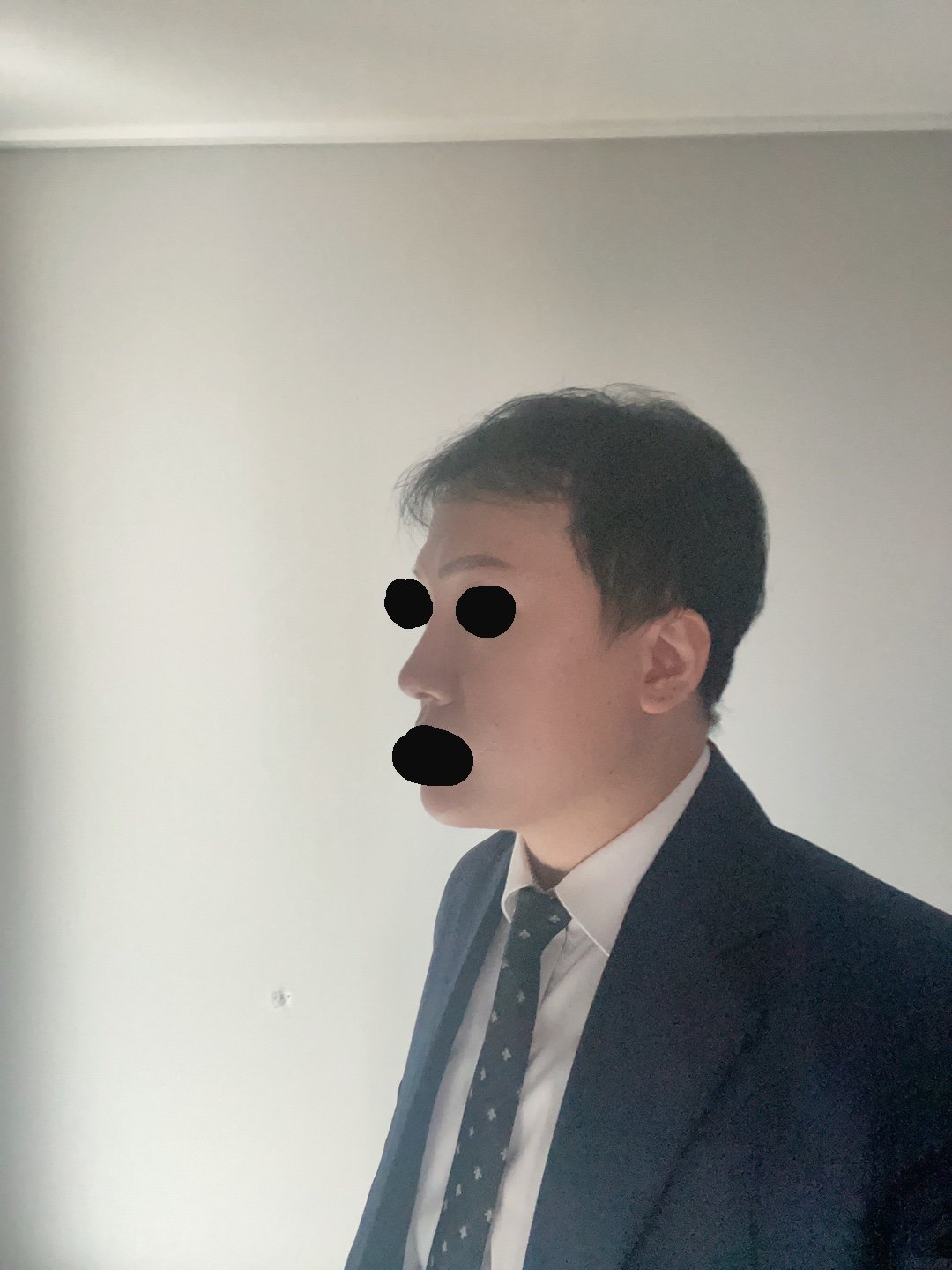 수술후기이미지