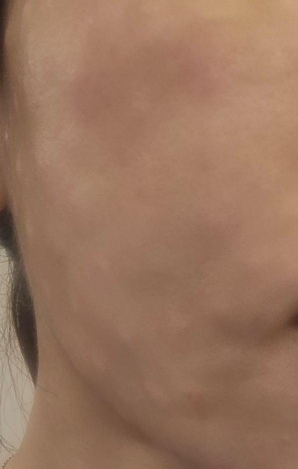 수술후기이미지