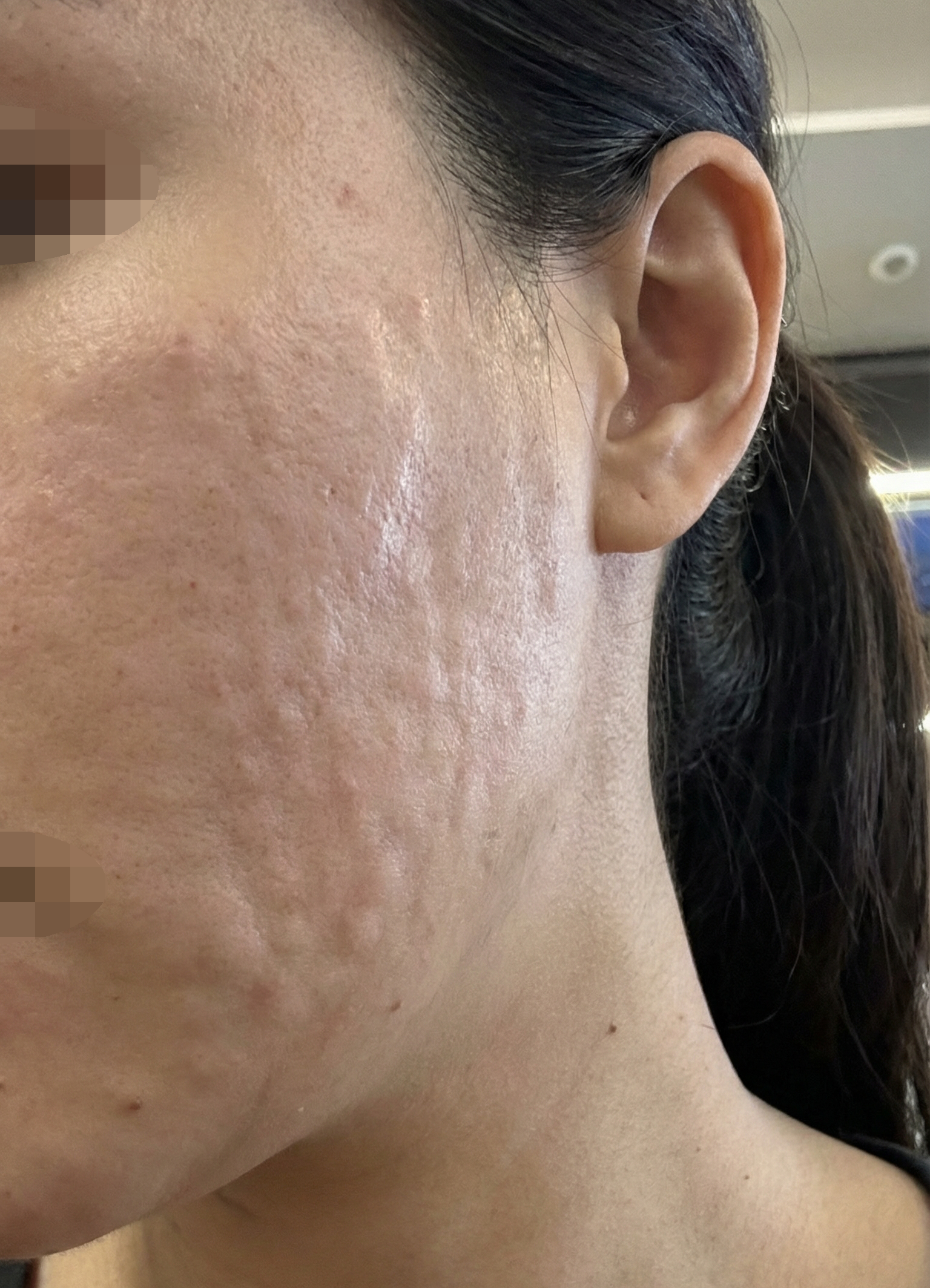 수술후기이미지