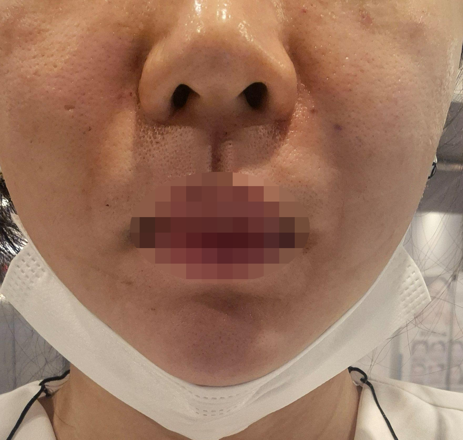 수술후기이미지