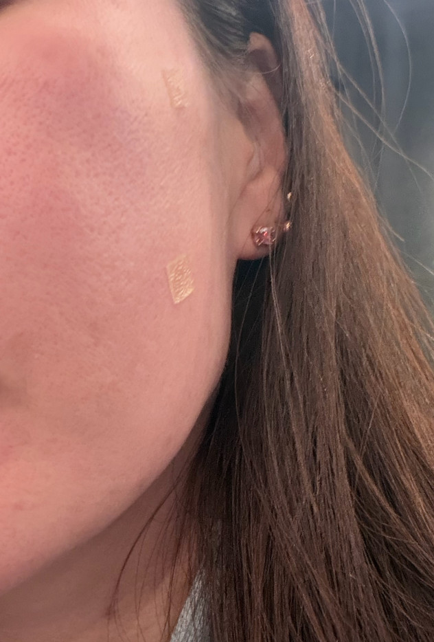 수술후기이미지