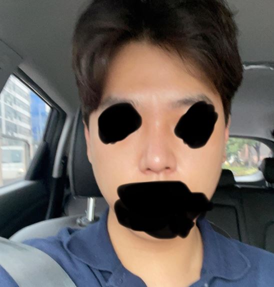 수술후기이미지