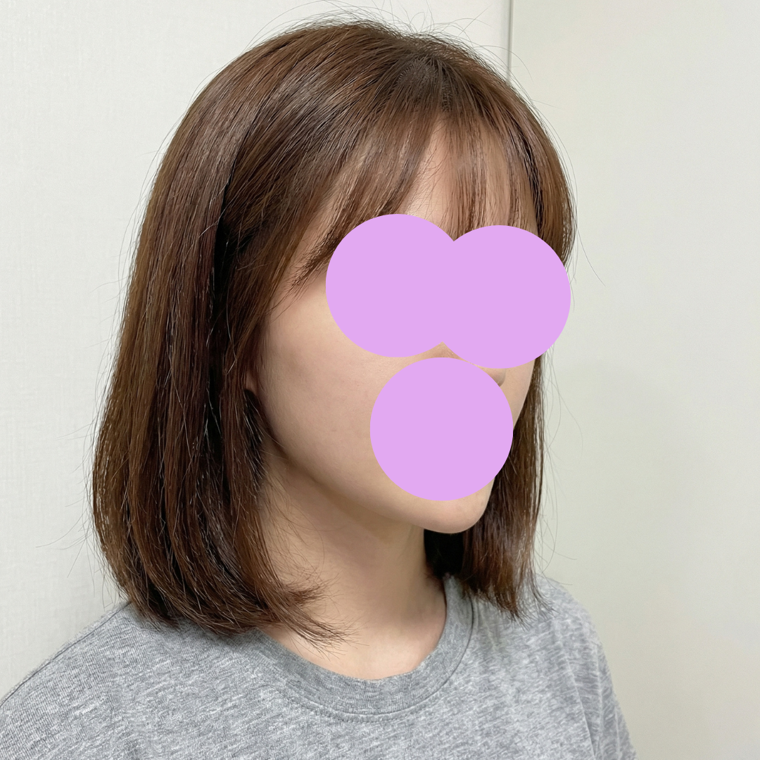 수술후기이미지