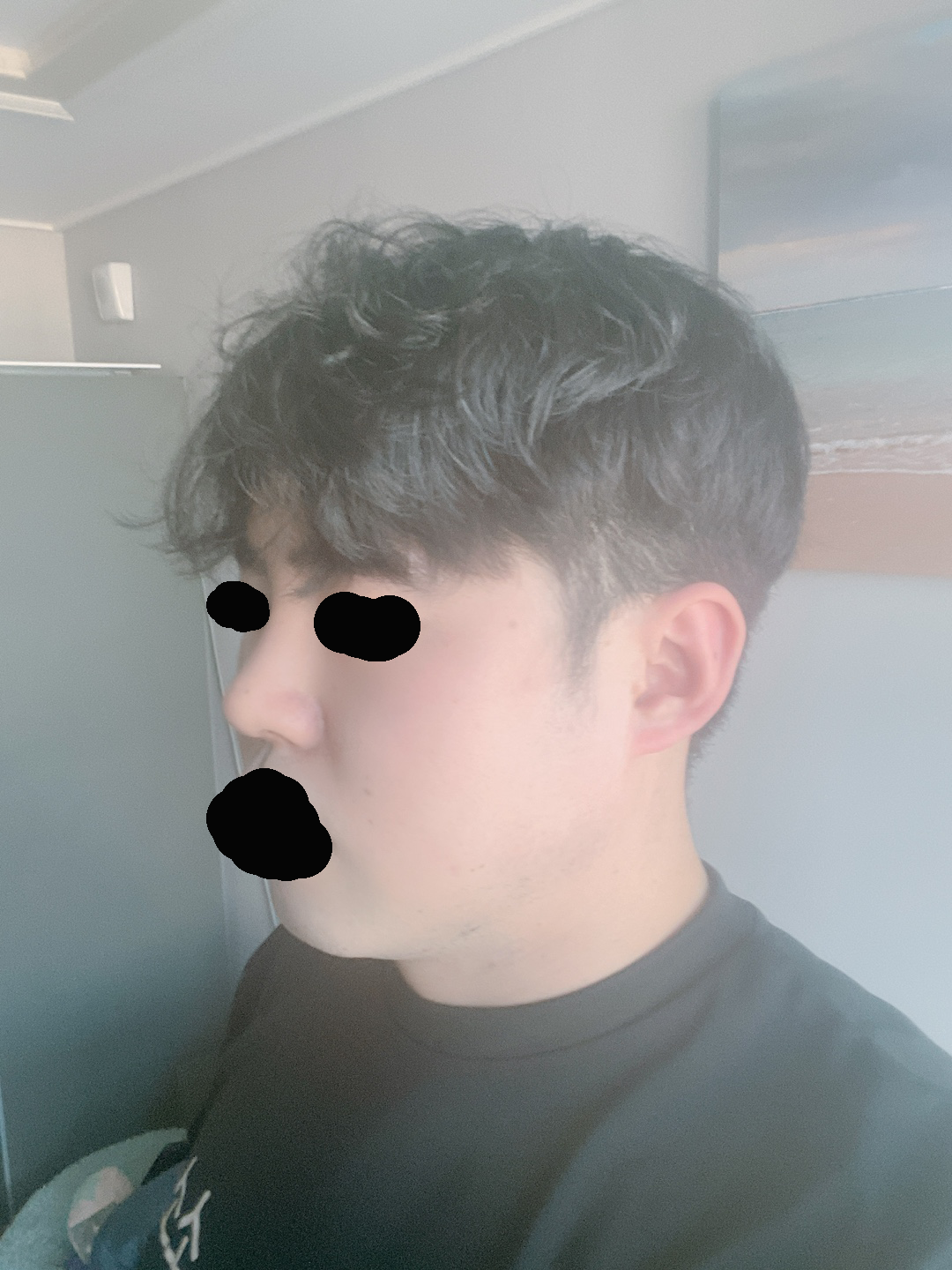 수술후기이미지