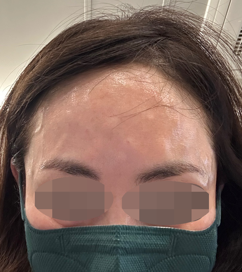 수술후기이미지