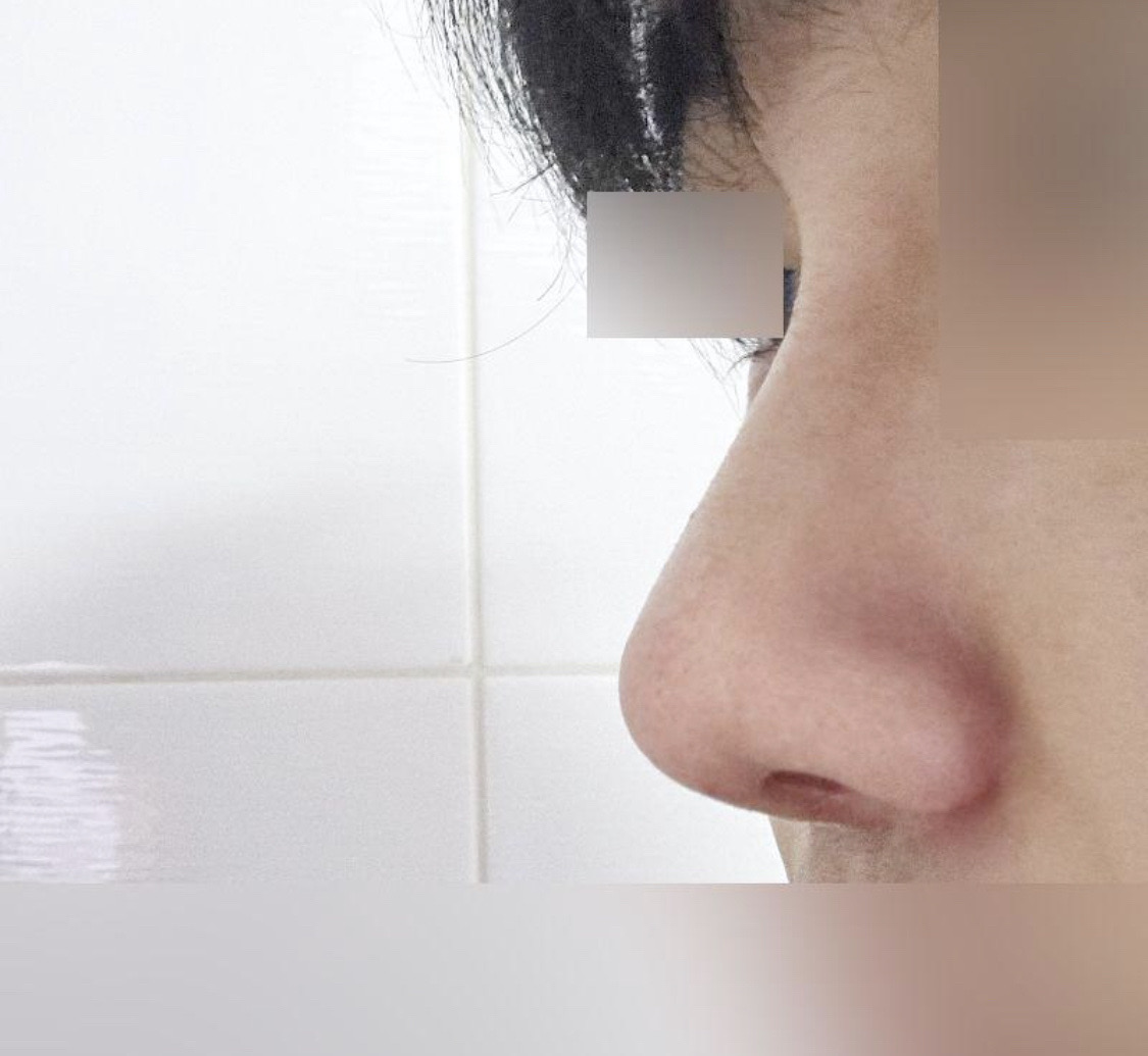 수술후기이미지