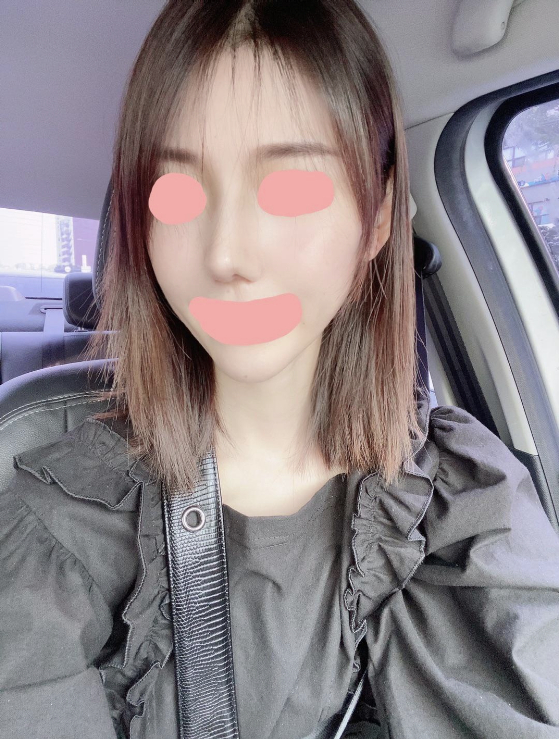 수술후기이미지