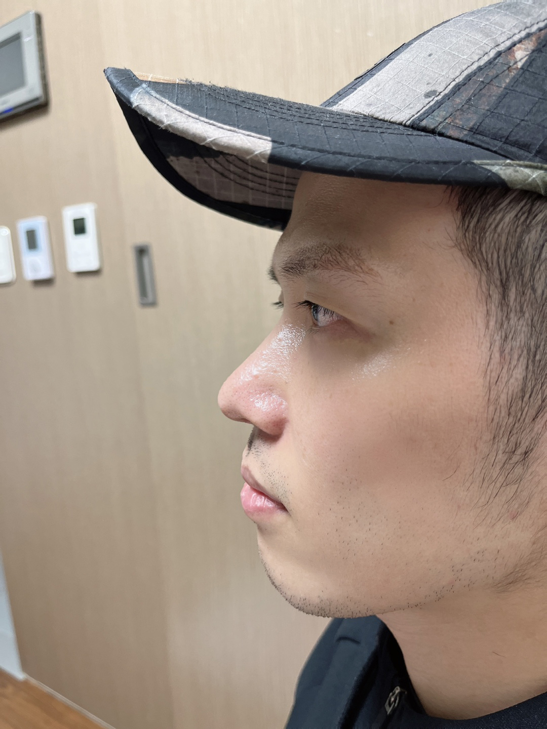 수술후기이미지