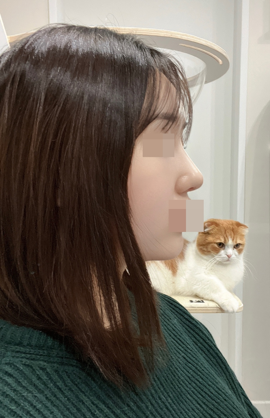 수술후기이미지