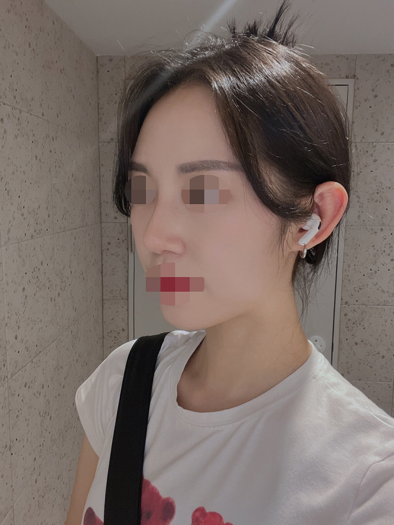 수술후기이미지