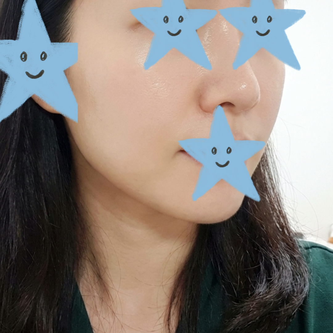 수술후기이미지