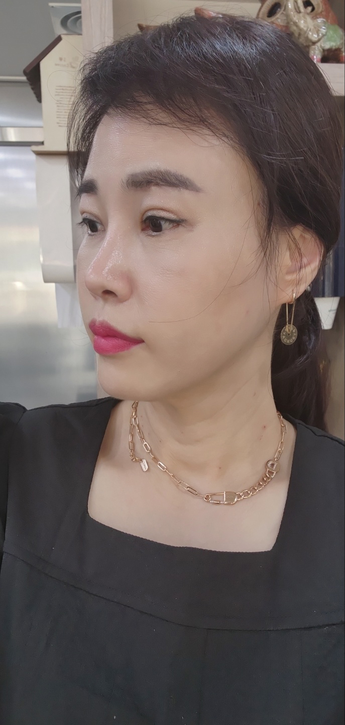 수술후기이미지