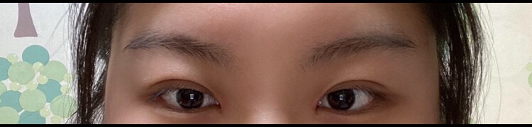 수술후기이미지