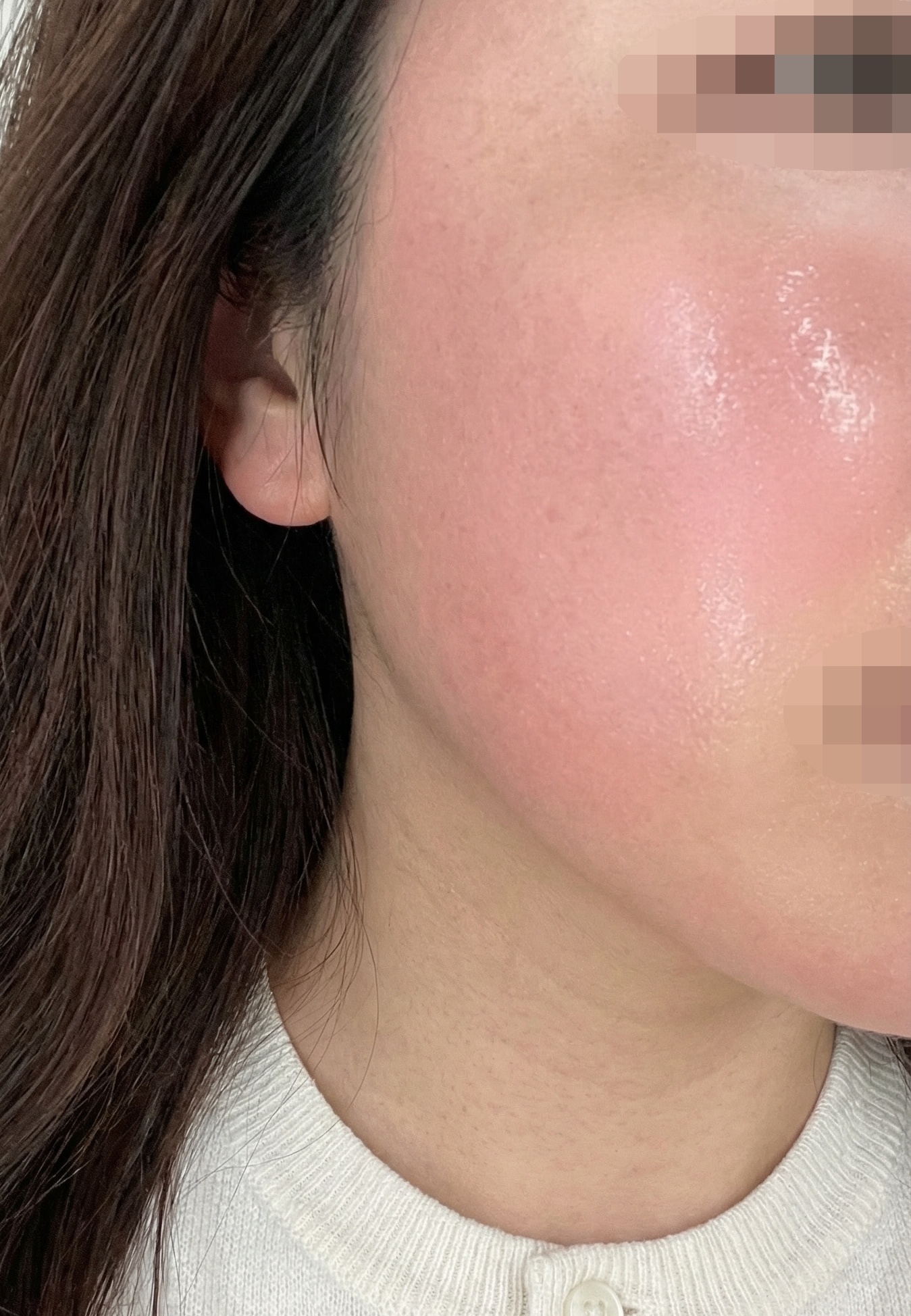 수술후기이미지