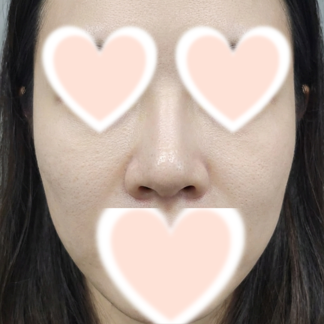 수술후기이미지