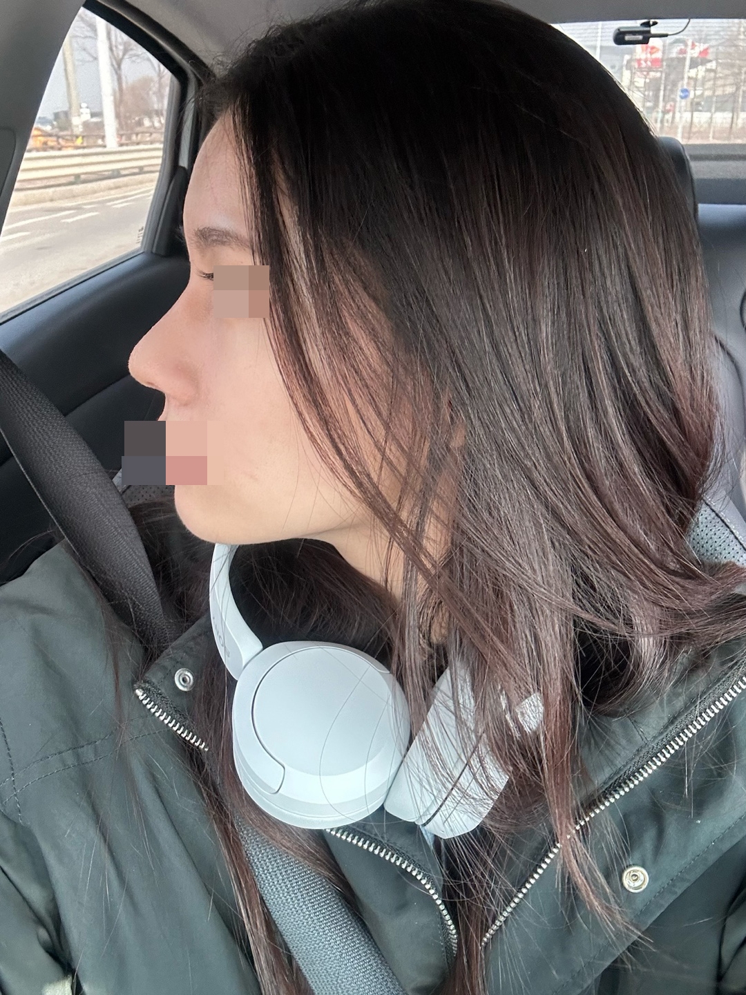 수술후기이미지