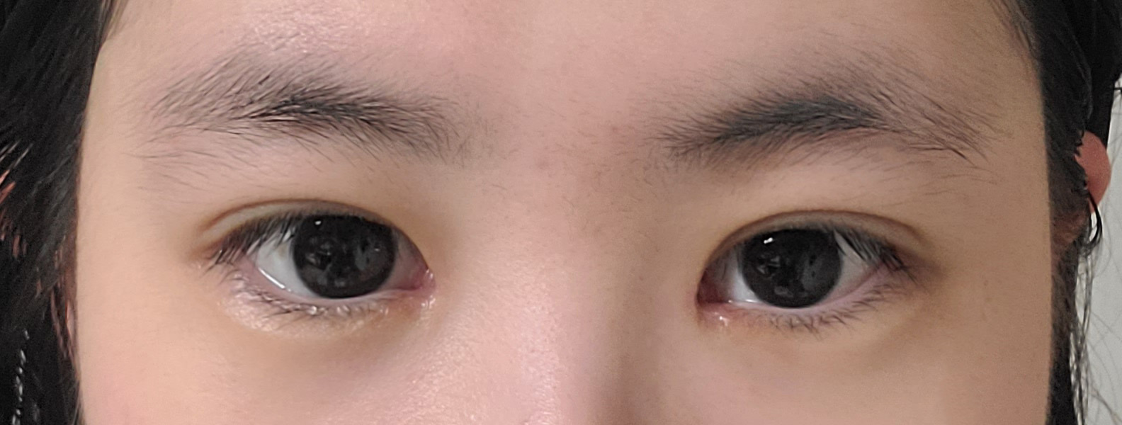 수술후기이미지