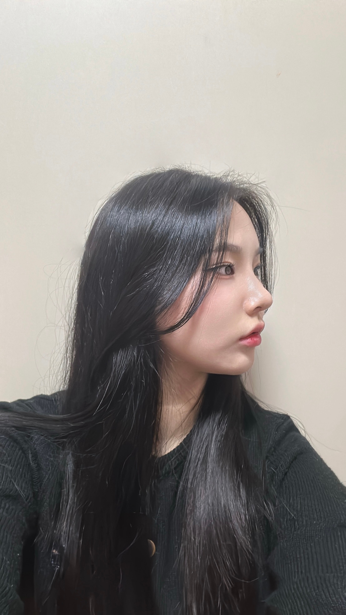 수술후기이미지