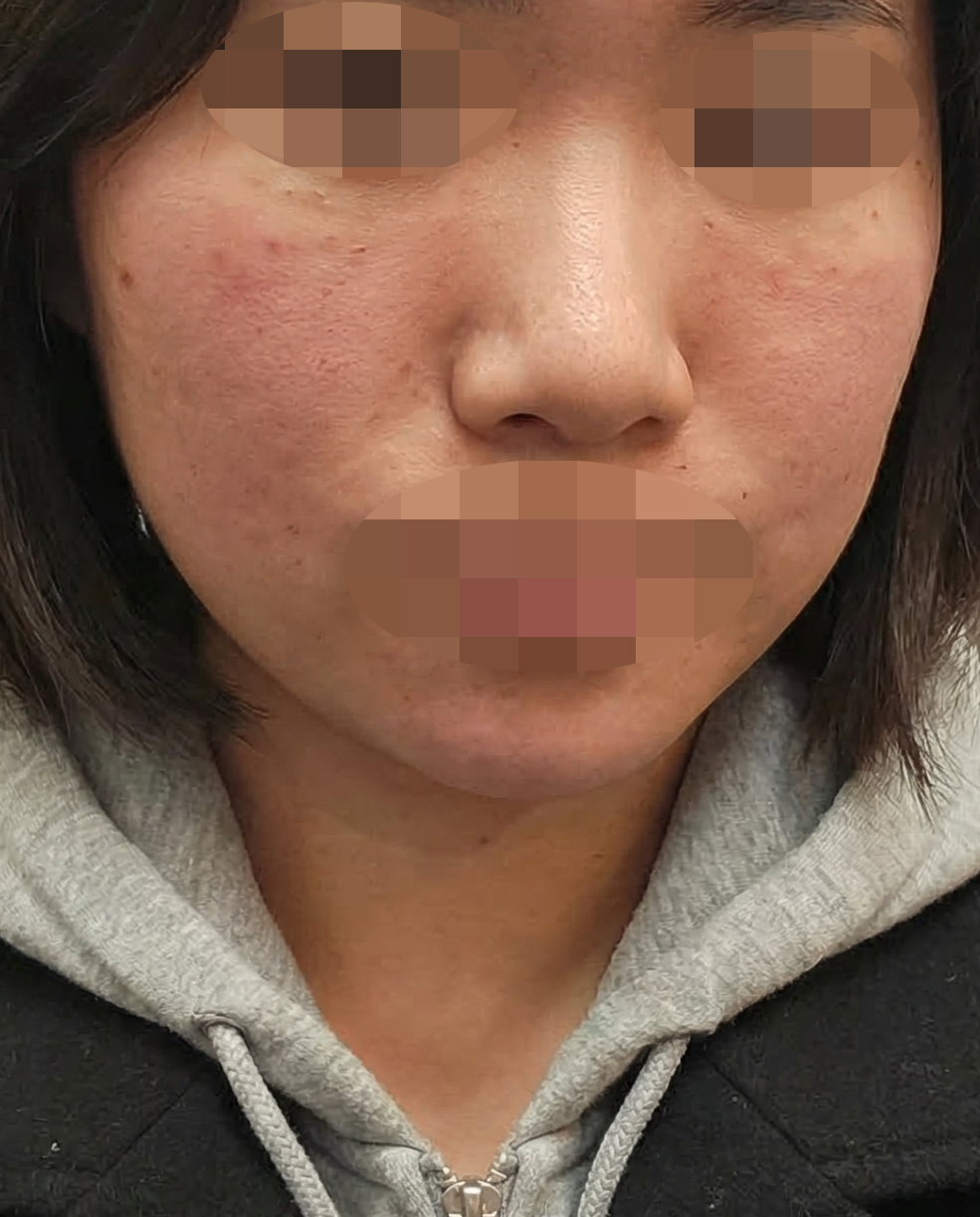 수술후기이미지