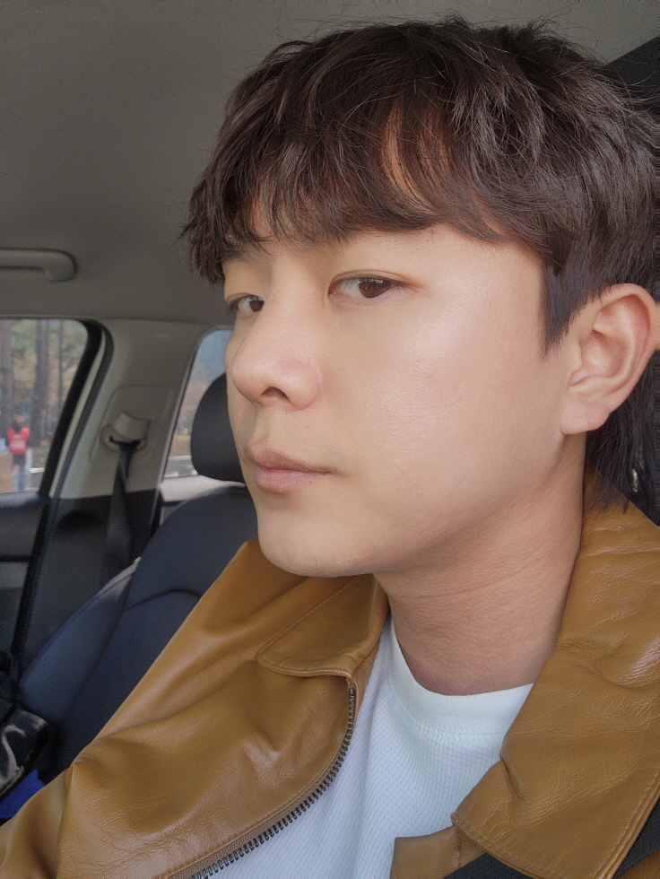 수술후기이미지