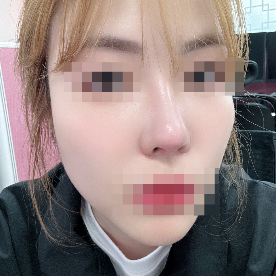 수술후기이미지