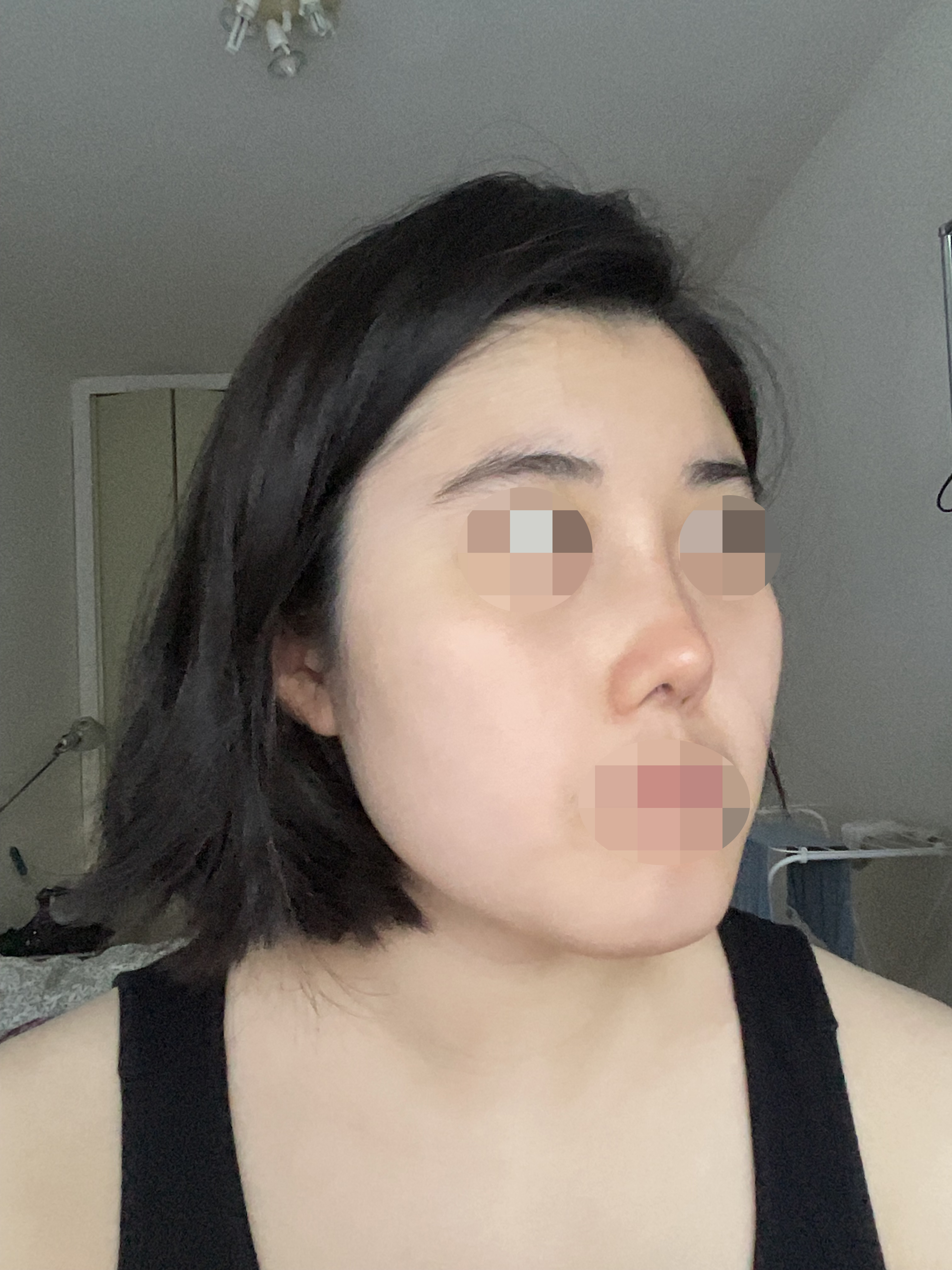 수술후기이미지