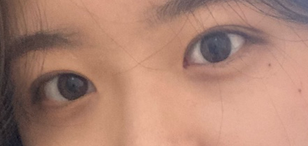 수술후기이미지