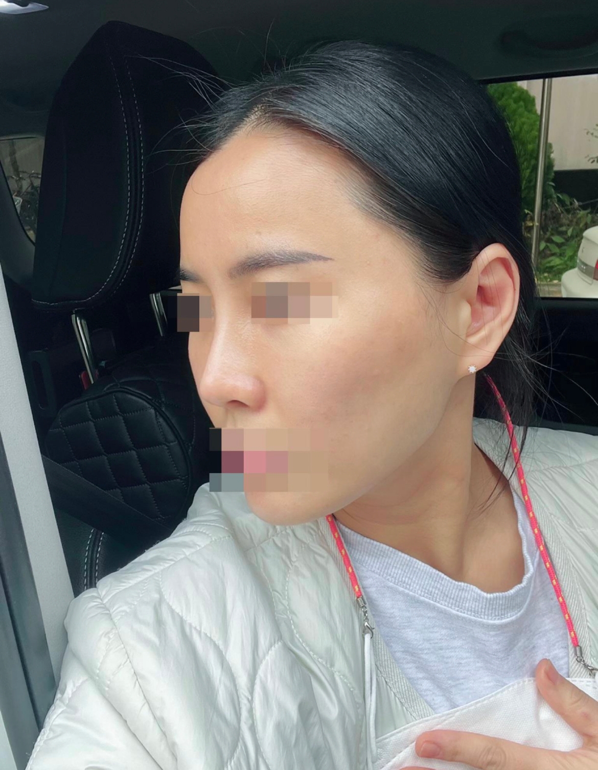 수술후기이미지