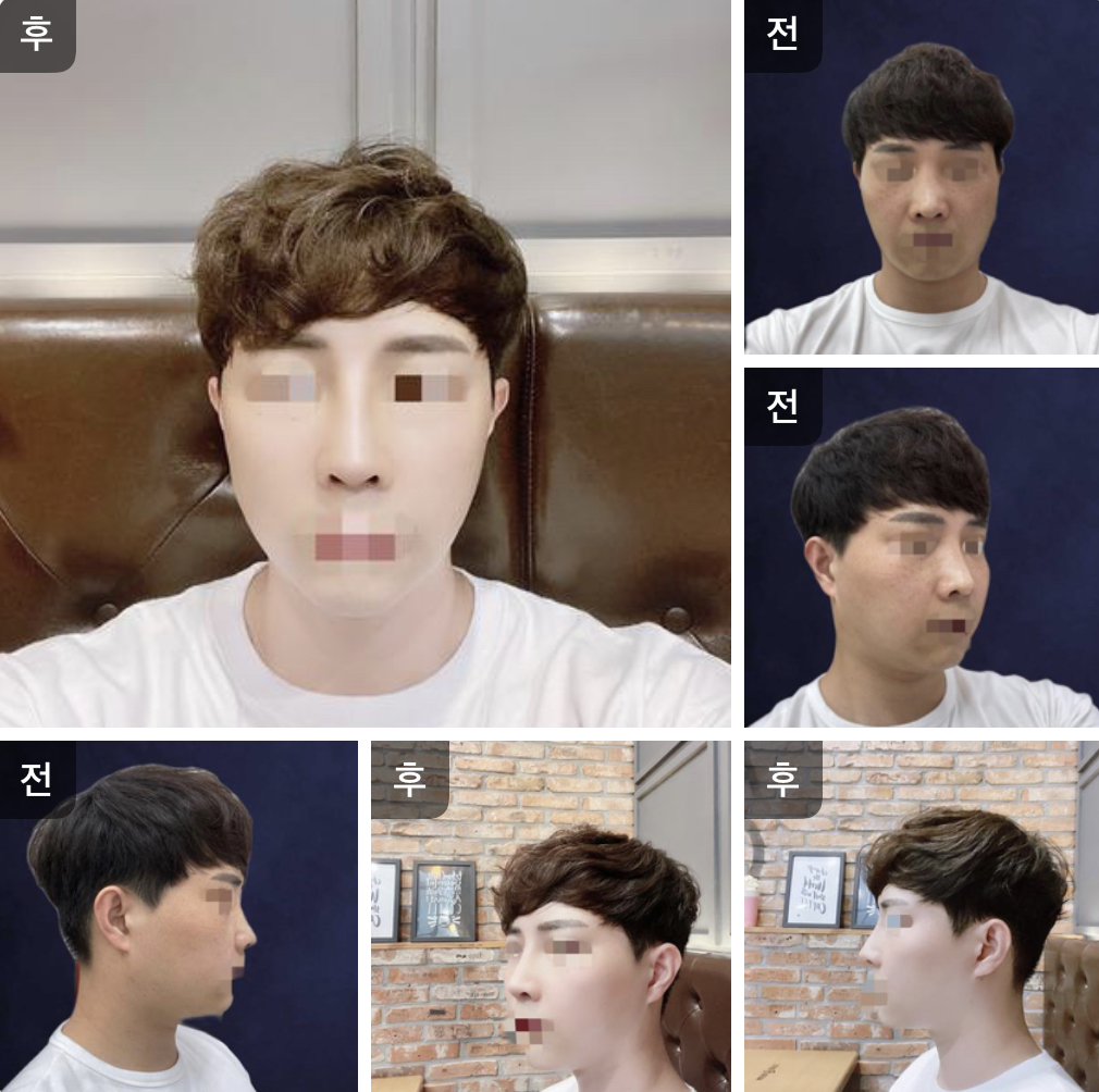 수술후기이미지