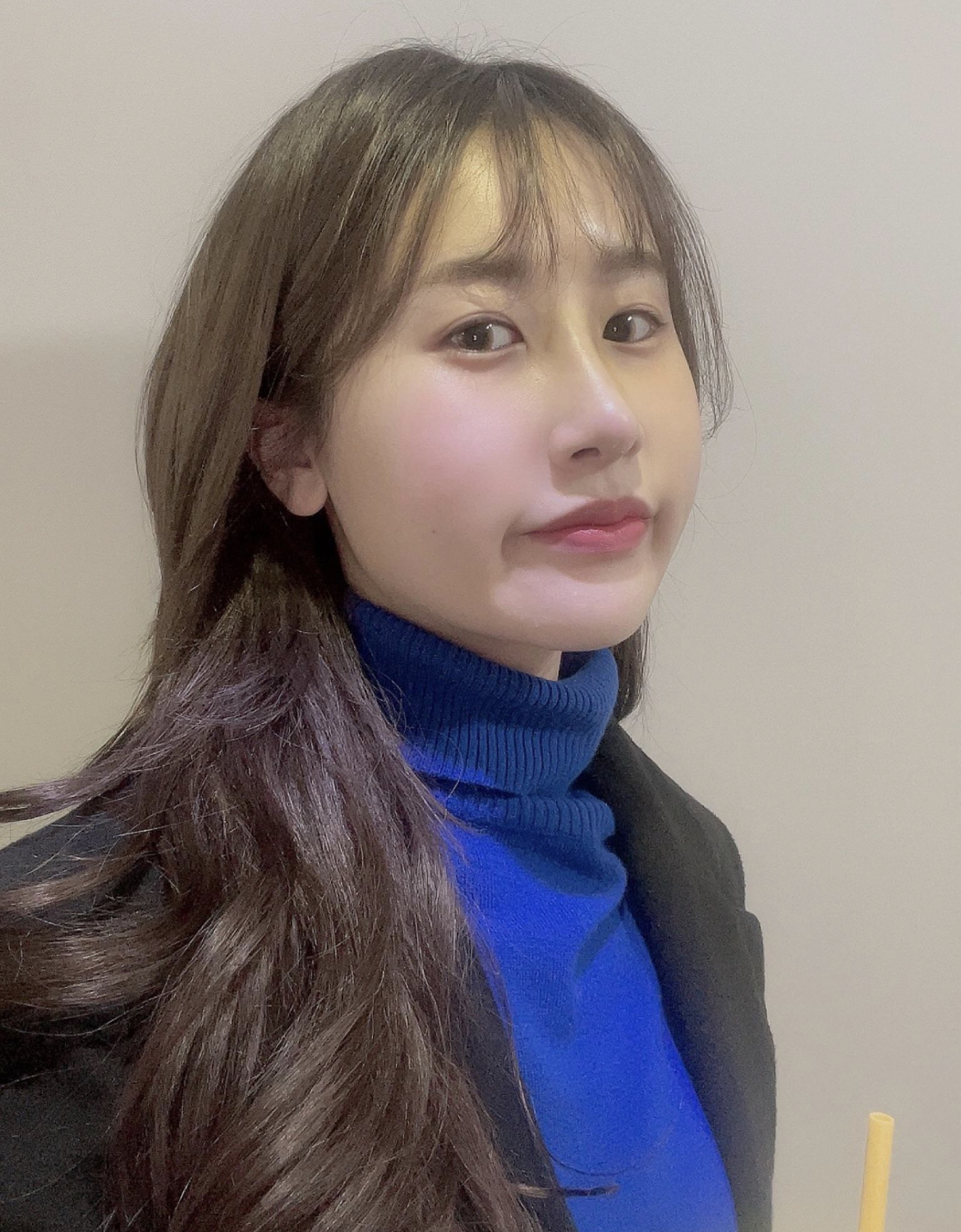 수술후기이미지