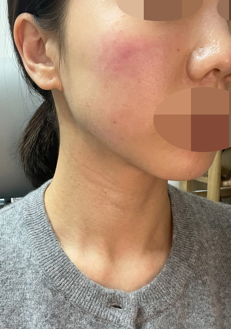 수술후기이미지