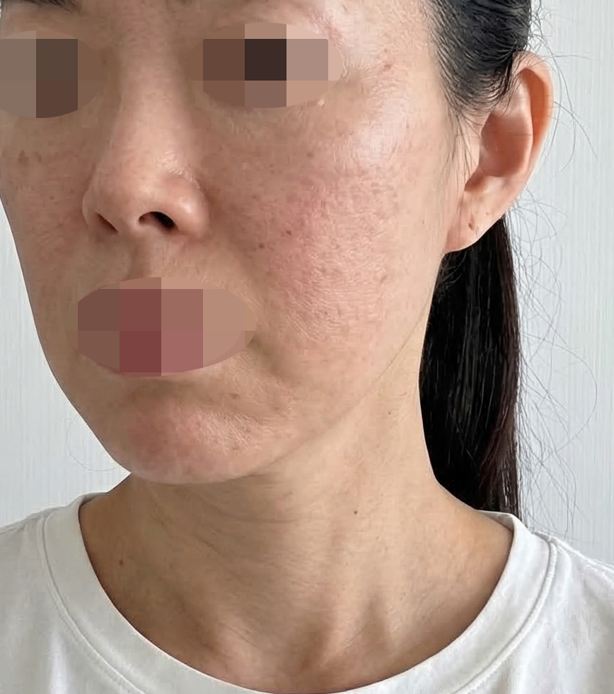 수술후기이미지