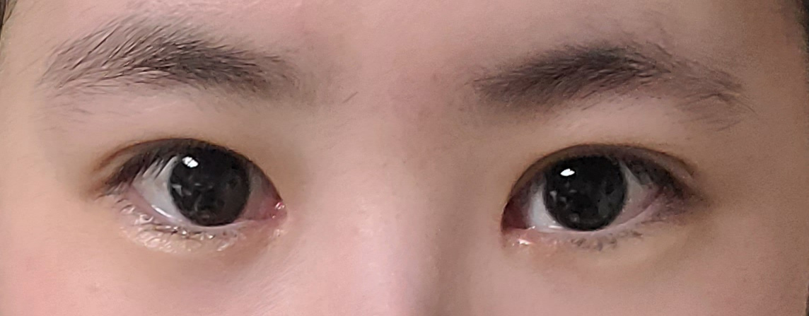 수술후기이미지
