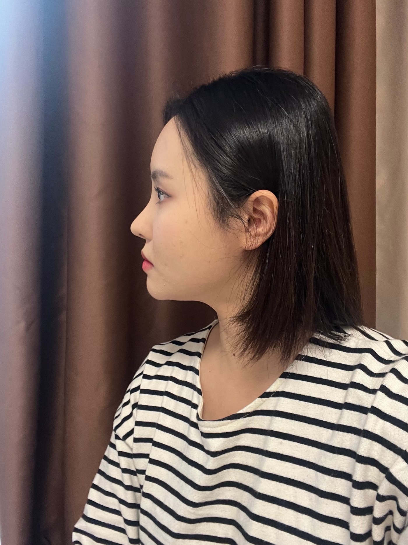 수술후기이미지