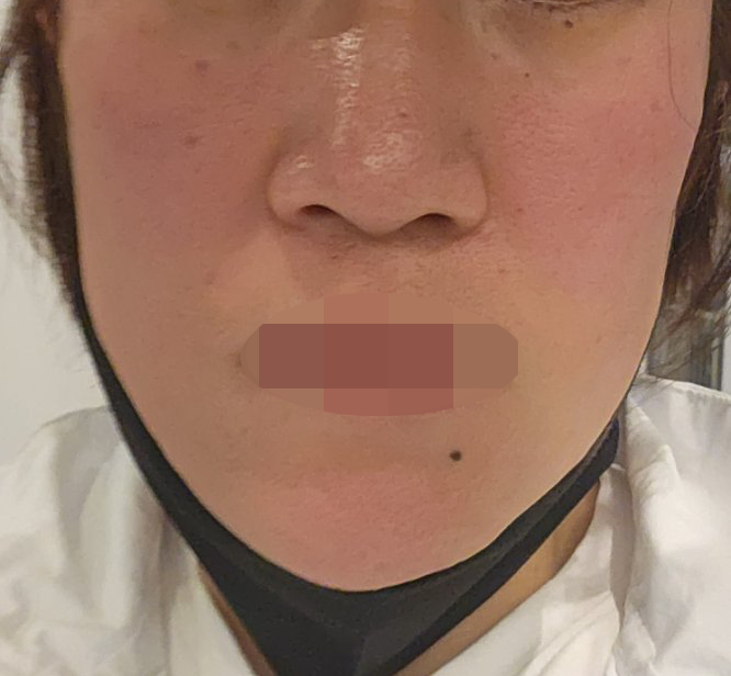 수술후기이미지