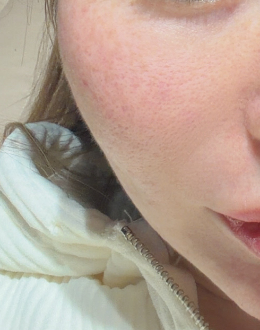 수술후기이미지