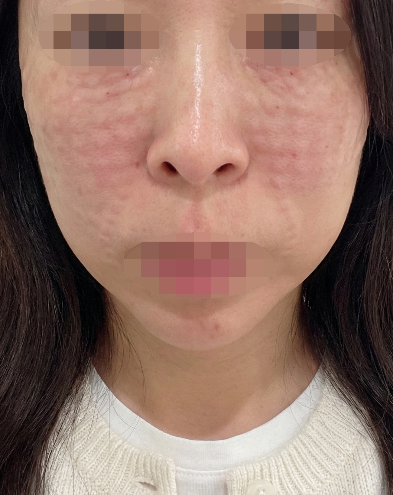 수술후기이미지