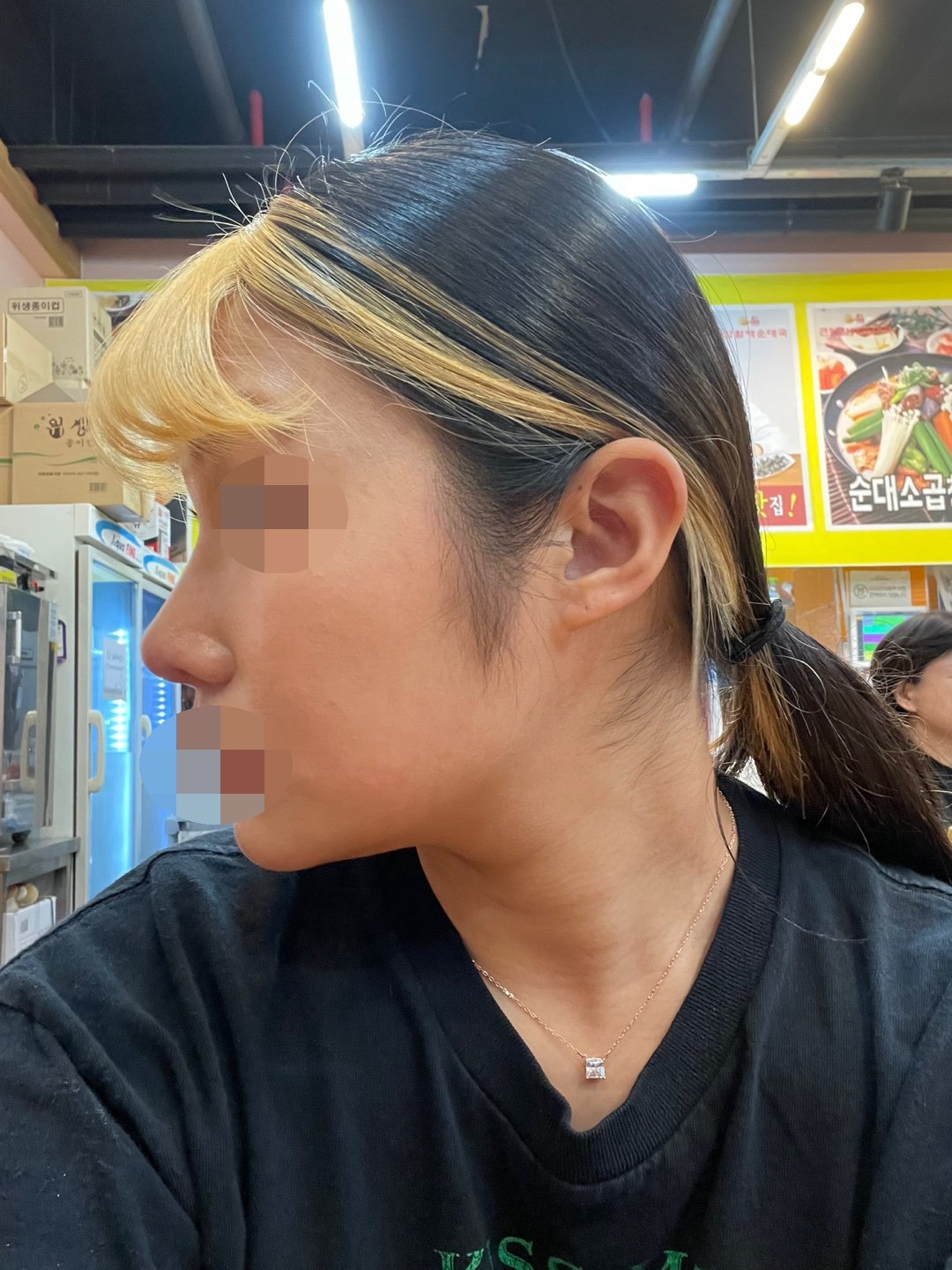 수술후기이미지