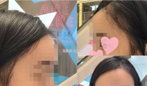 수술후기이미지