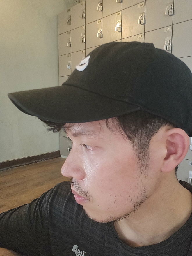 수술후기이미지