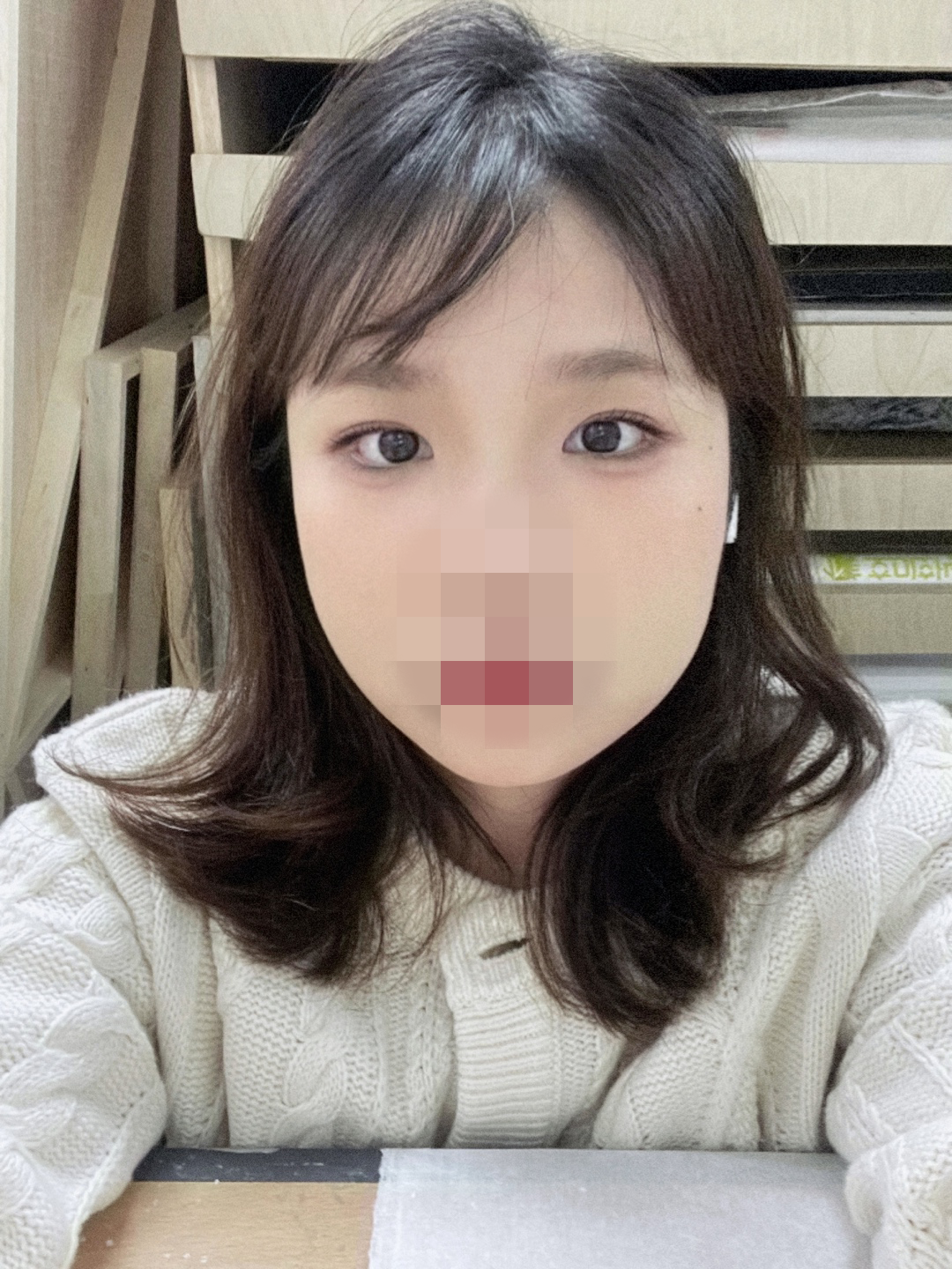 수술후기이미지