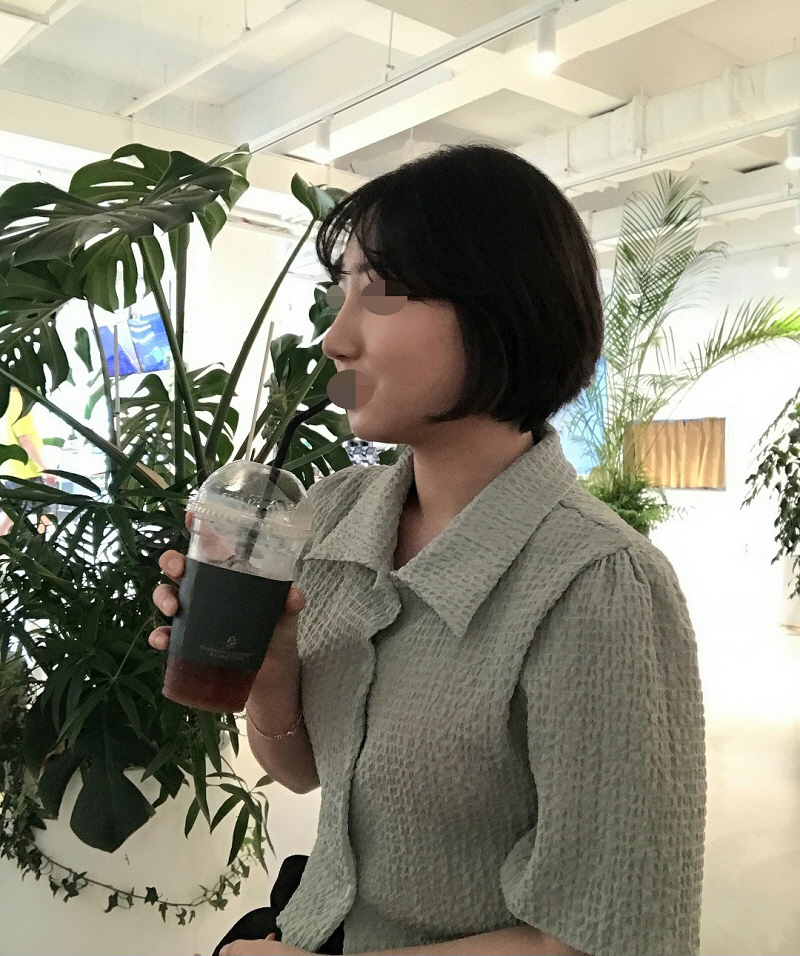 수술후기이미지