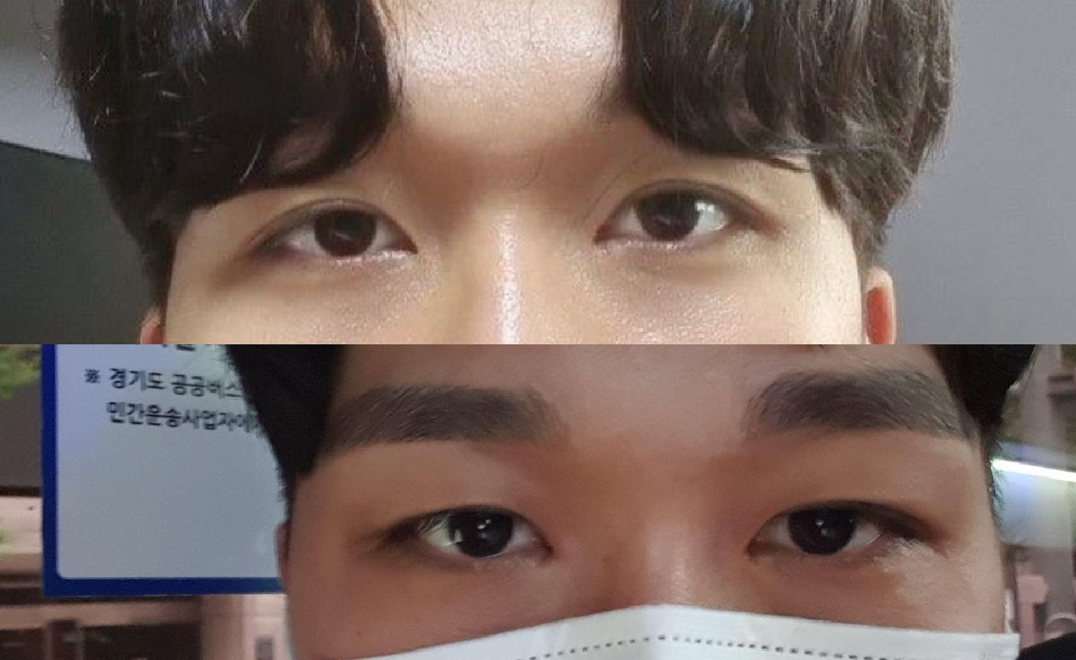 수술후기이미지