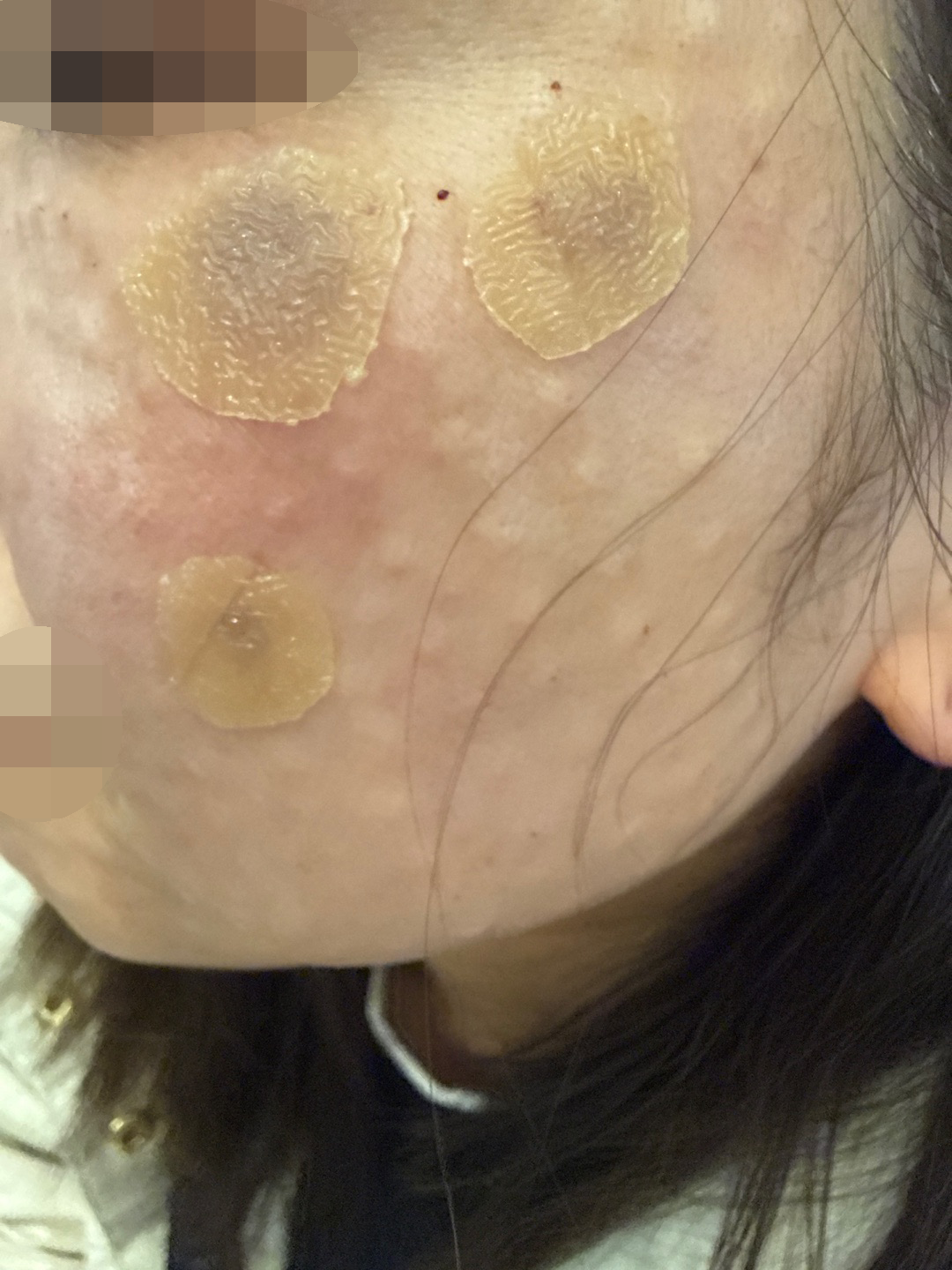 수술후기이미지