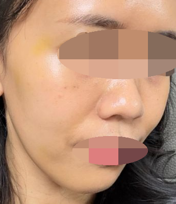 수술후기이미지