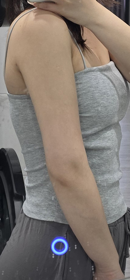 수술후기이미지