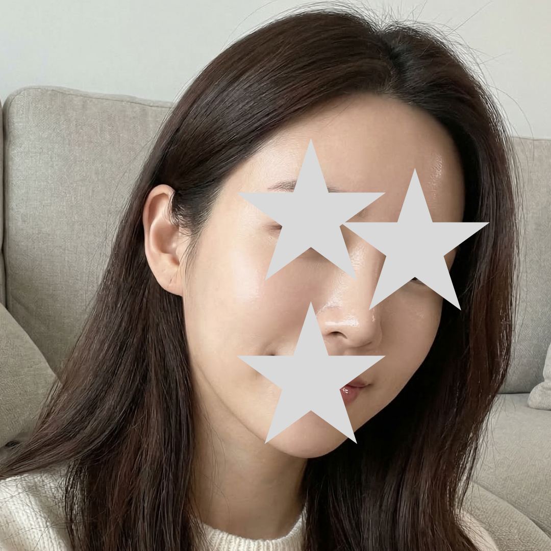 수술후기이미지