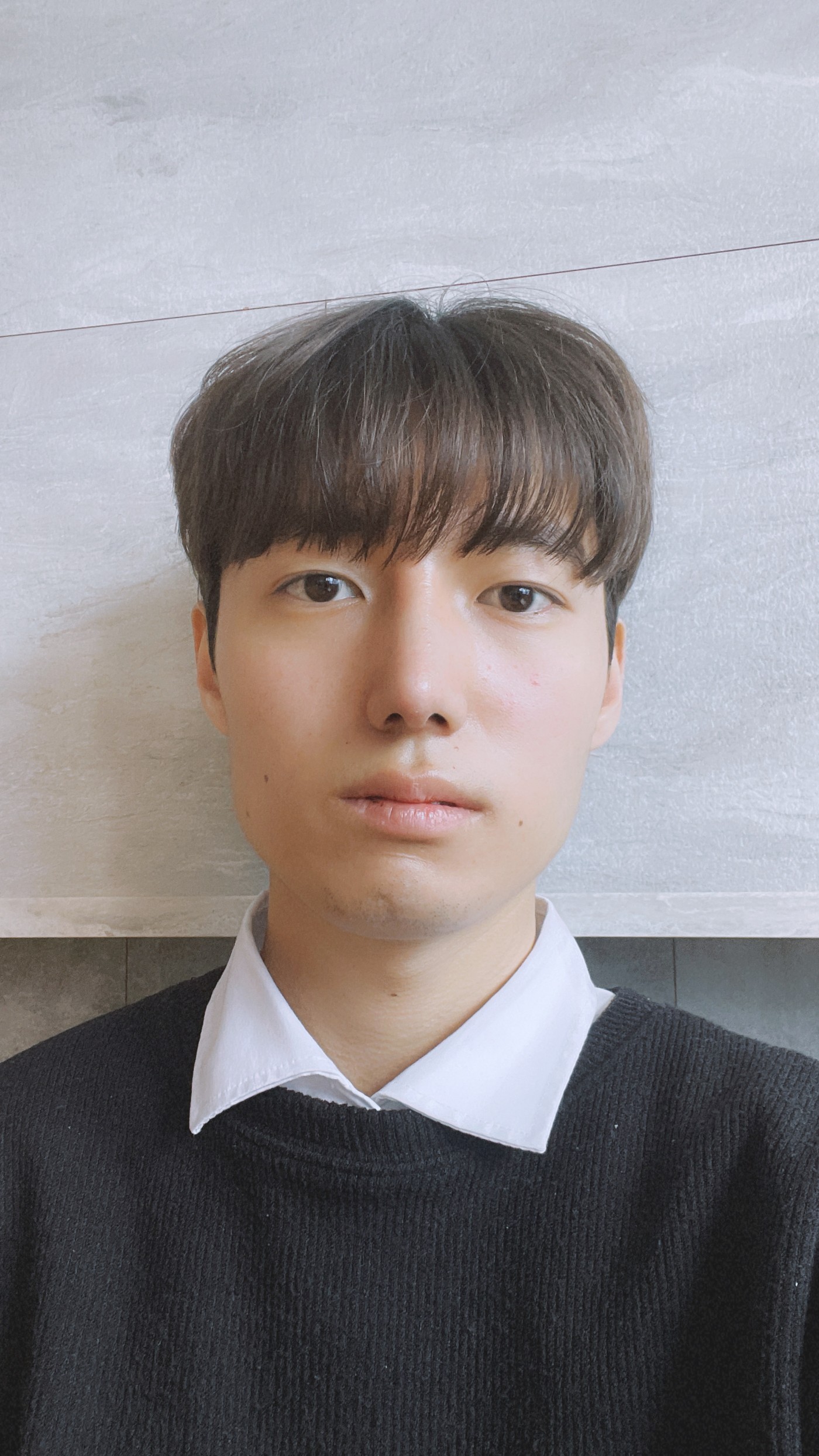 수술후기이미지