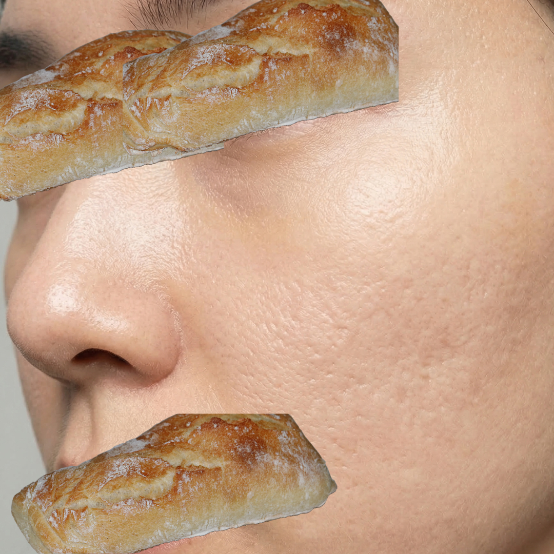 수술후기이미지